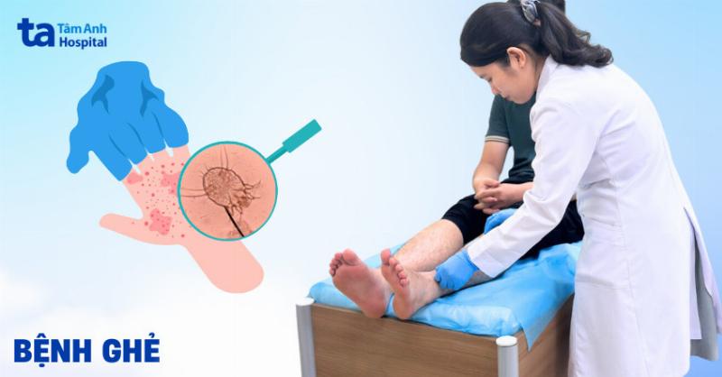 Hình ảnh mô phỏng ghẻ ở vùng kín nam giới, một trong các loại mụn ở bộ phận sinh dục nam gây ngứa dữ dội